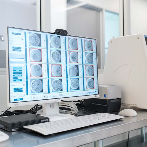 Egg Retrieval Process: What to Expect