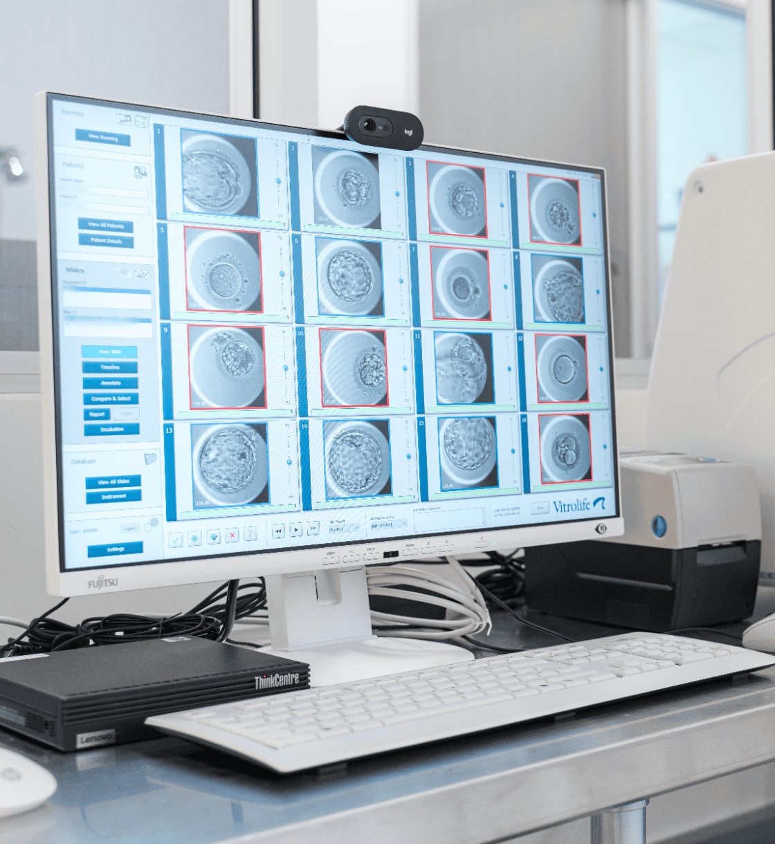 The EmbryoScope captures images of each embryo every 10 minutes to create time-lapse videos.